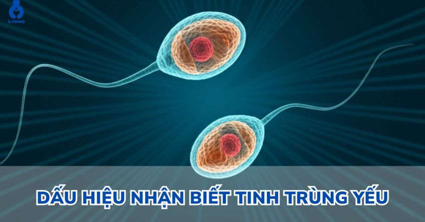 Dấu hiệu nhận biết tinh trùng yếu - Phải để ý từ sớm