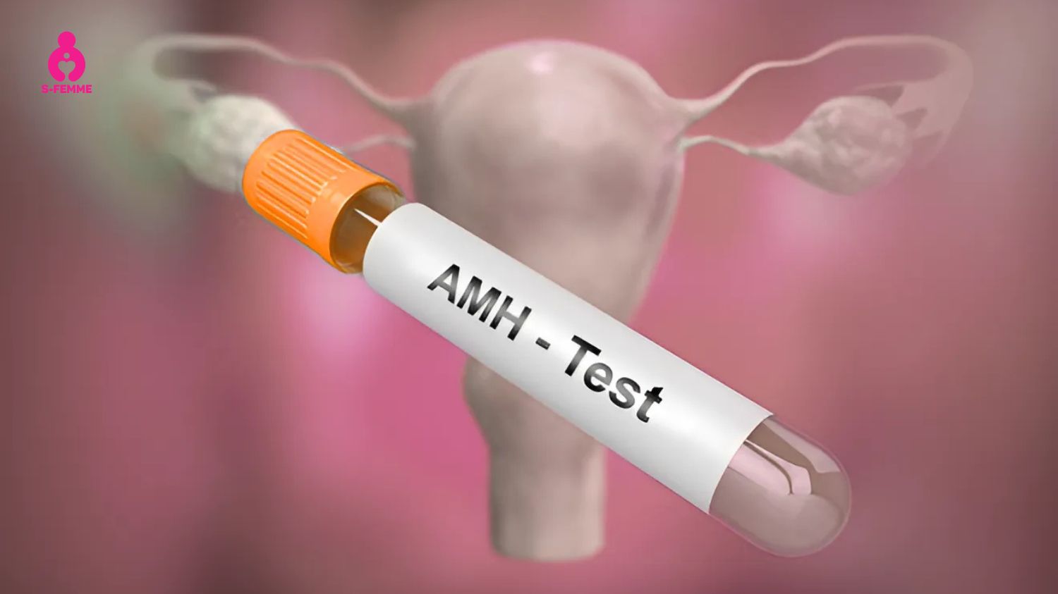 Biện pháp chẩn đoán trứng kém phát triển Anti Mullerian Hormone