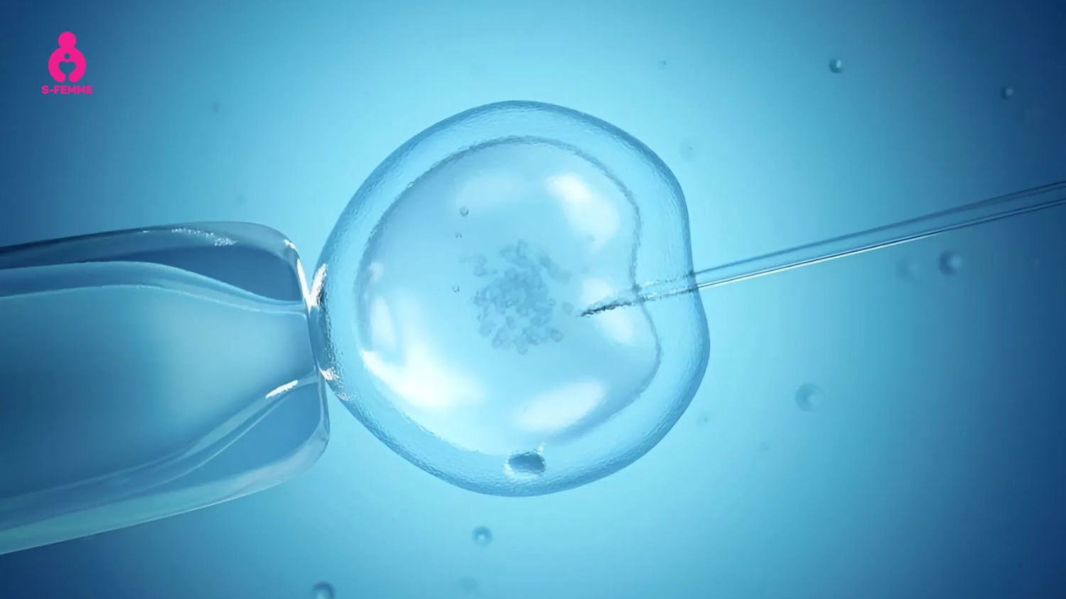 Điều trị trứng kém ở phụ nữ bằng phương pháp thụ tinh trong ống nghiệm (IVF)