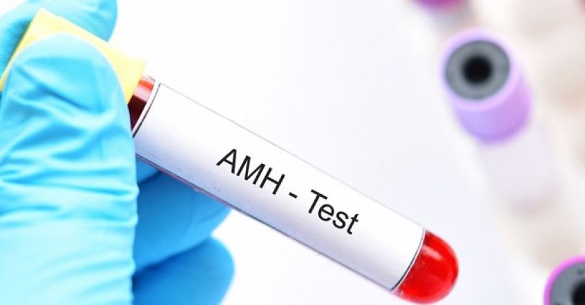 Xét nghiệm đánh giá giảm dự trữ buồng trứng (AMH thấp)