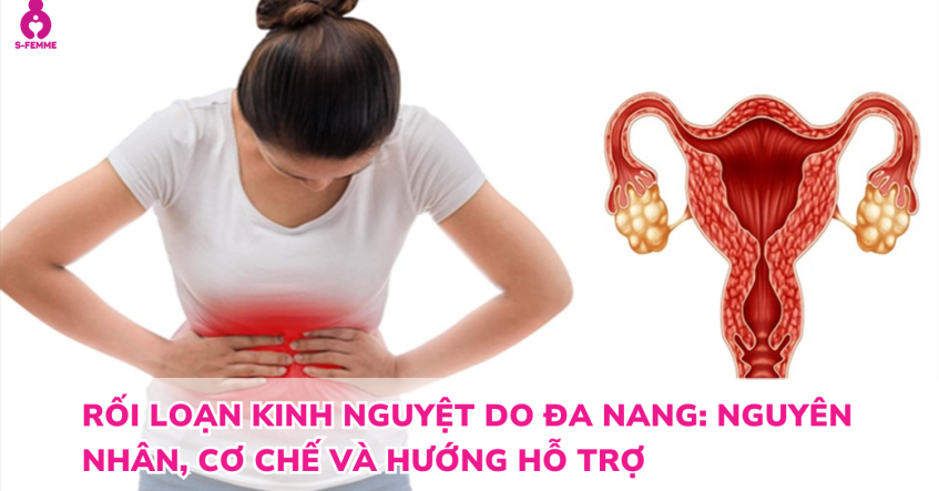 Rối loạn kinh nguyệt do đa nang: Nguyên nhân, cơ chế và hướng hỗ trợ