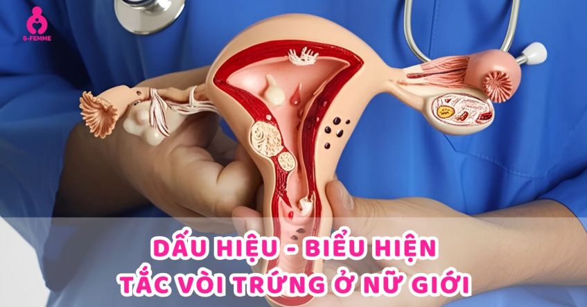 Dấu hiệu tắc vòi trứng​ mà phụ nữ dễ bỏ qua