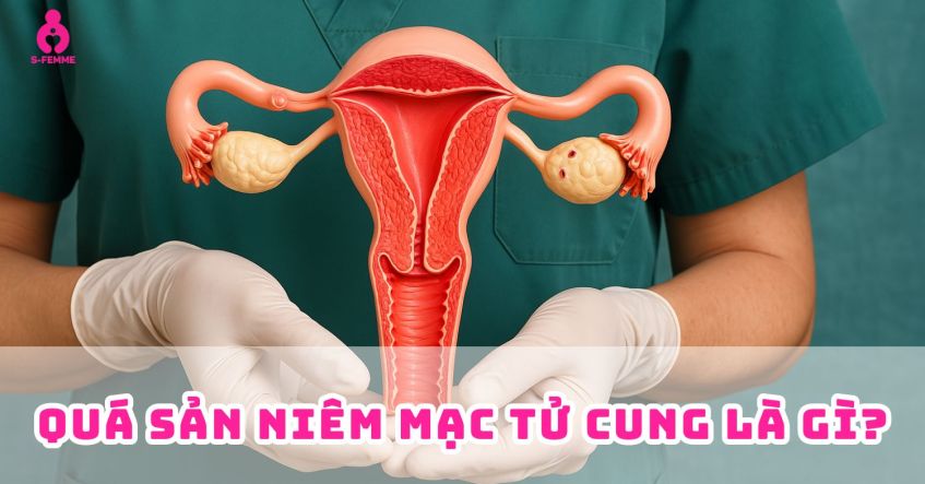 Quá sản niêm mạc tử cung là gì​? Dấu hiệu nhận biết