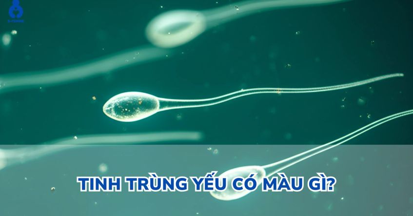 Tinh trùng yếu có màu gì​? Dấu hiệu không thể bỏ qua
