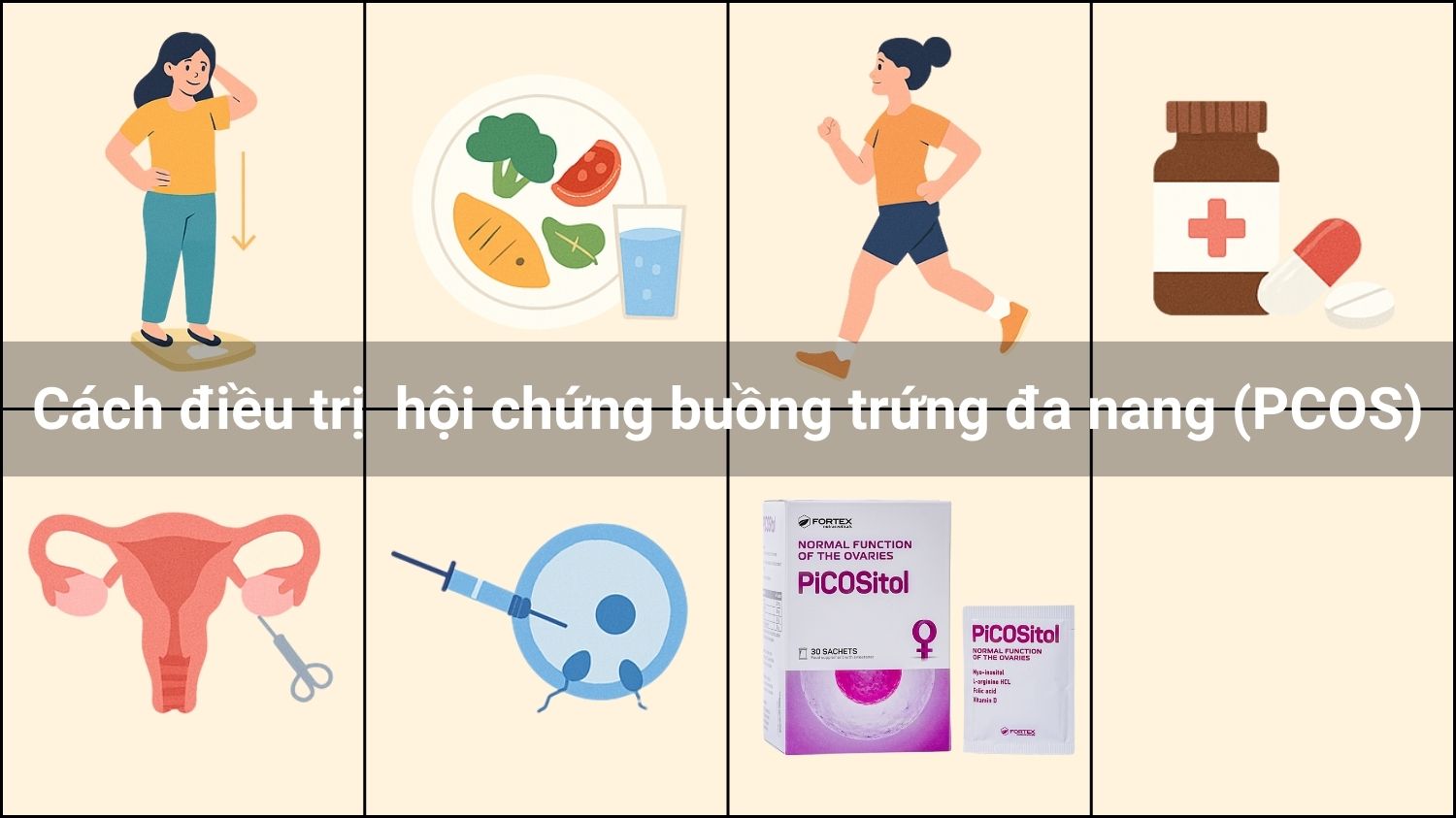Cách điều trị đa nang buồng trứng (PCOS)