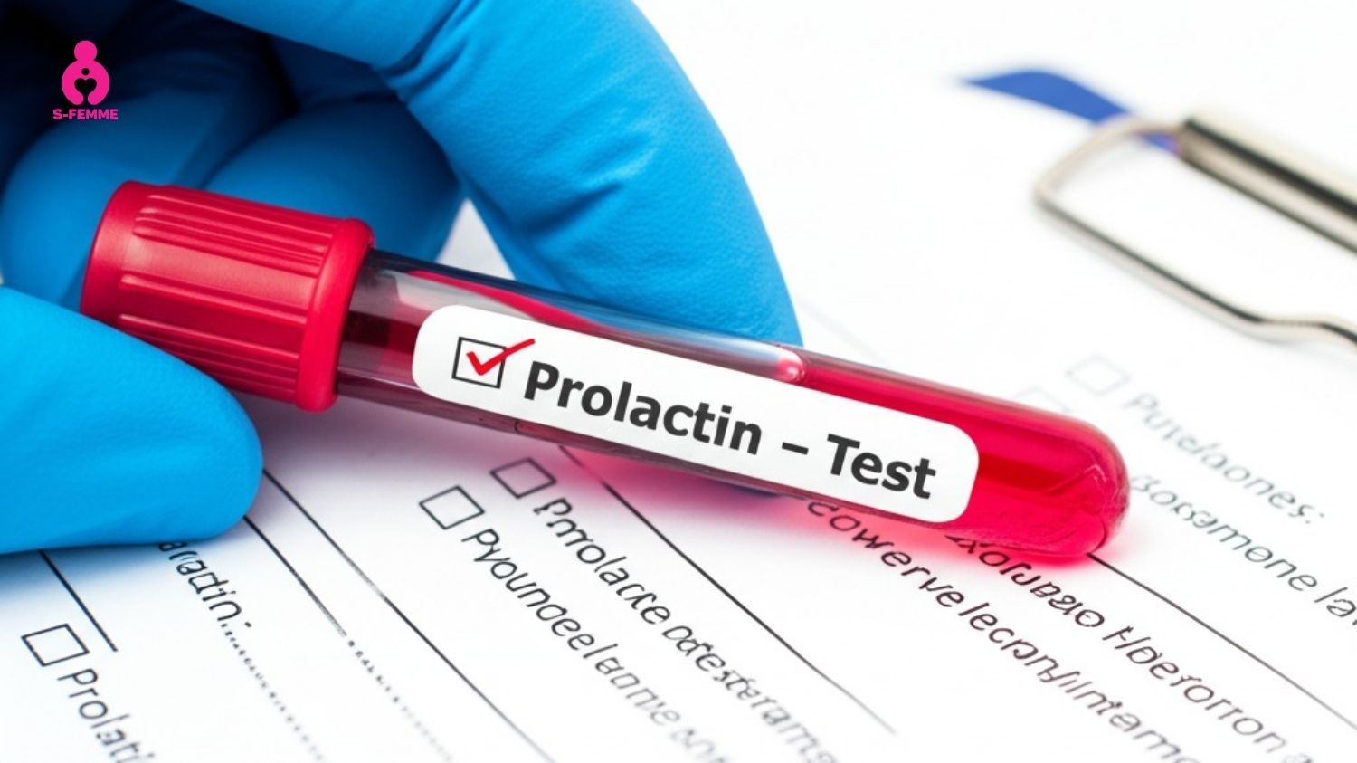 Nguyên nhân phụ nữ vô sinh do tăng prolactin máu dẫn đến