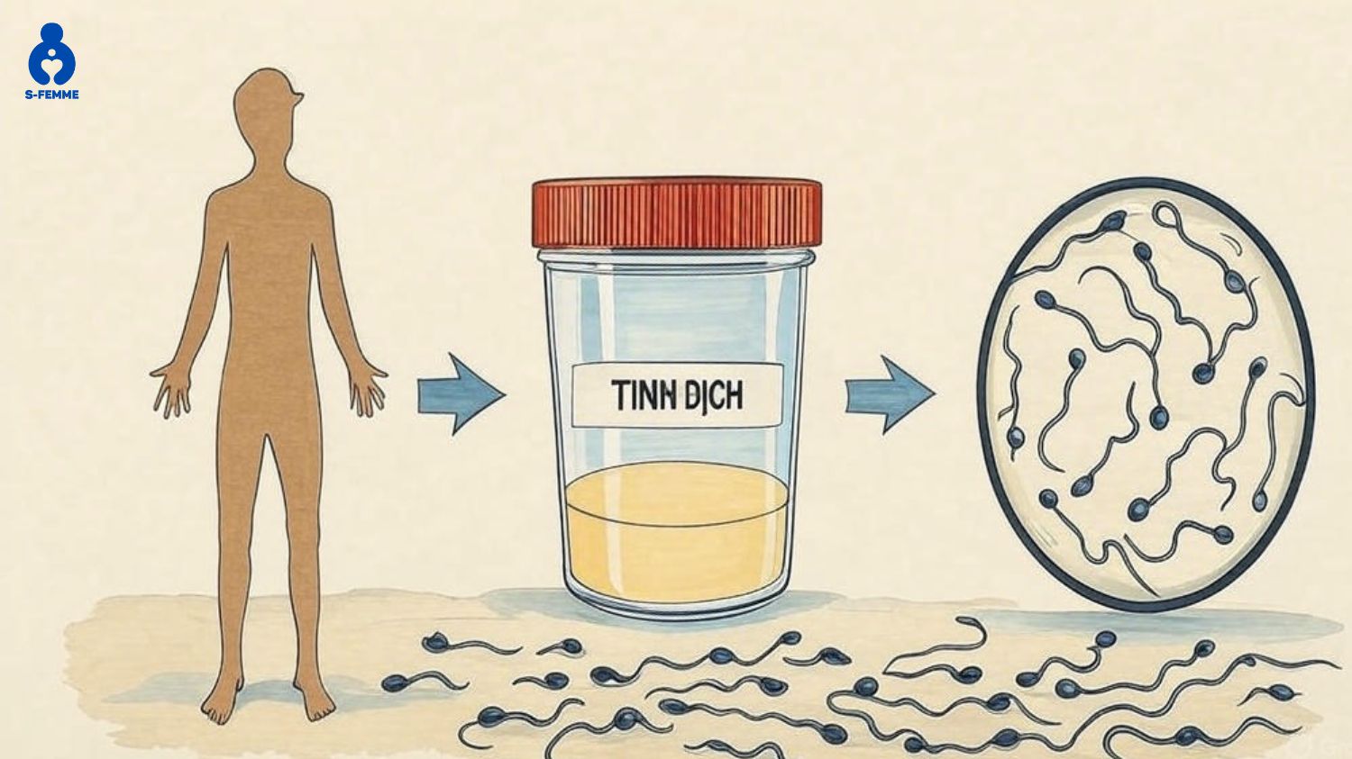 Những phương pháp chẩn đoán tinh trùng bị loãng